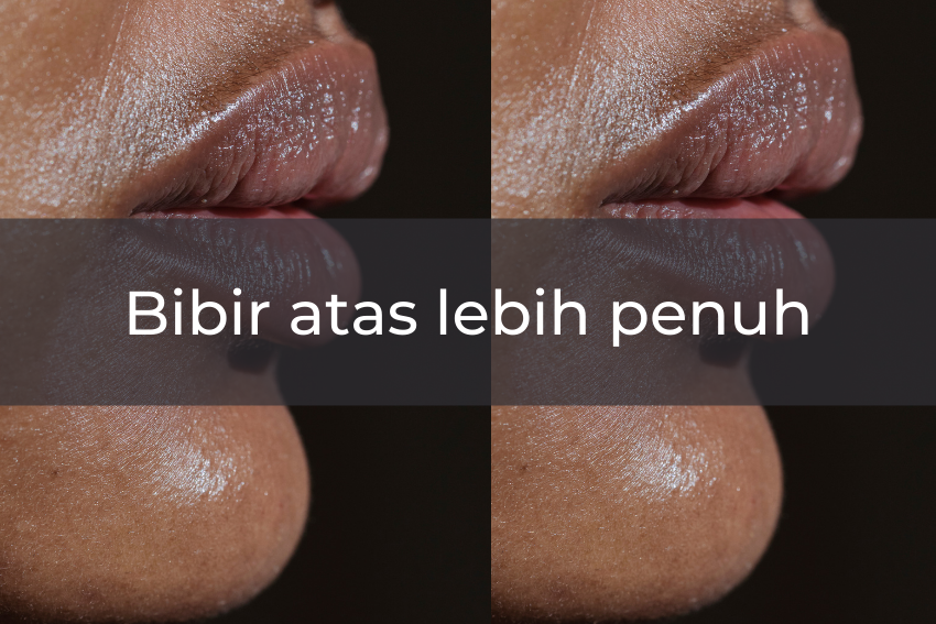 Pexels.com