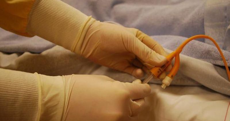 Penjelasan, Cara Menggunakan, dan Jenis Kateter Urine