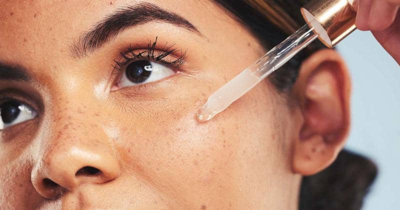 Cara Mengatasi Purging Akibat Retinol, Kamu Nggak Perlu Khawatir ...