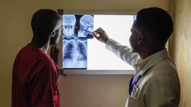 Sejarah Pneumonia, Penyakit Berbahaya yang Membunuh Jutaan Jiwa