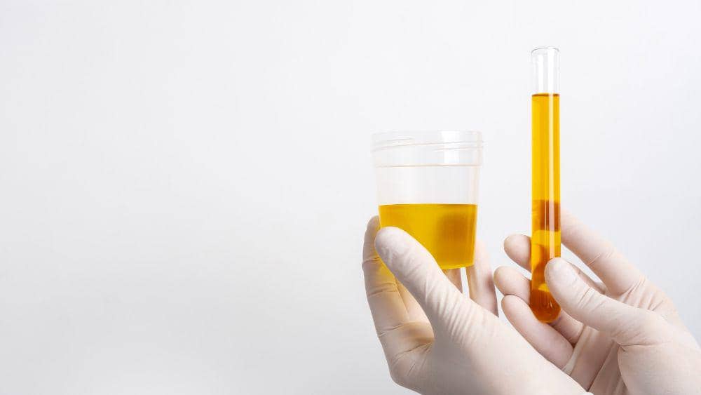 ilustrasi urine (freepik.com/freepik