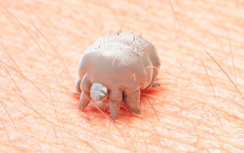 Ilustrasi Tungau Scabies (fumida.co.id/Fumida)