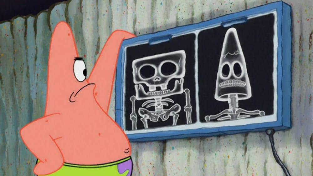 Patrick meneliti bagaimana cara mengembalikan hubungannya dengan SpongeBob (dok. Nickelodeon/SpongeBob SquarePants)