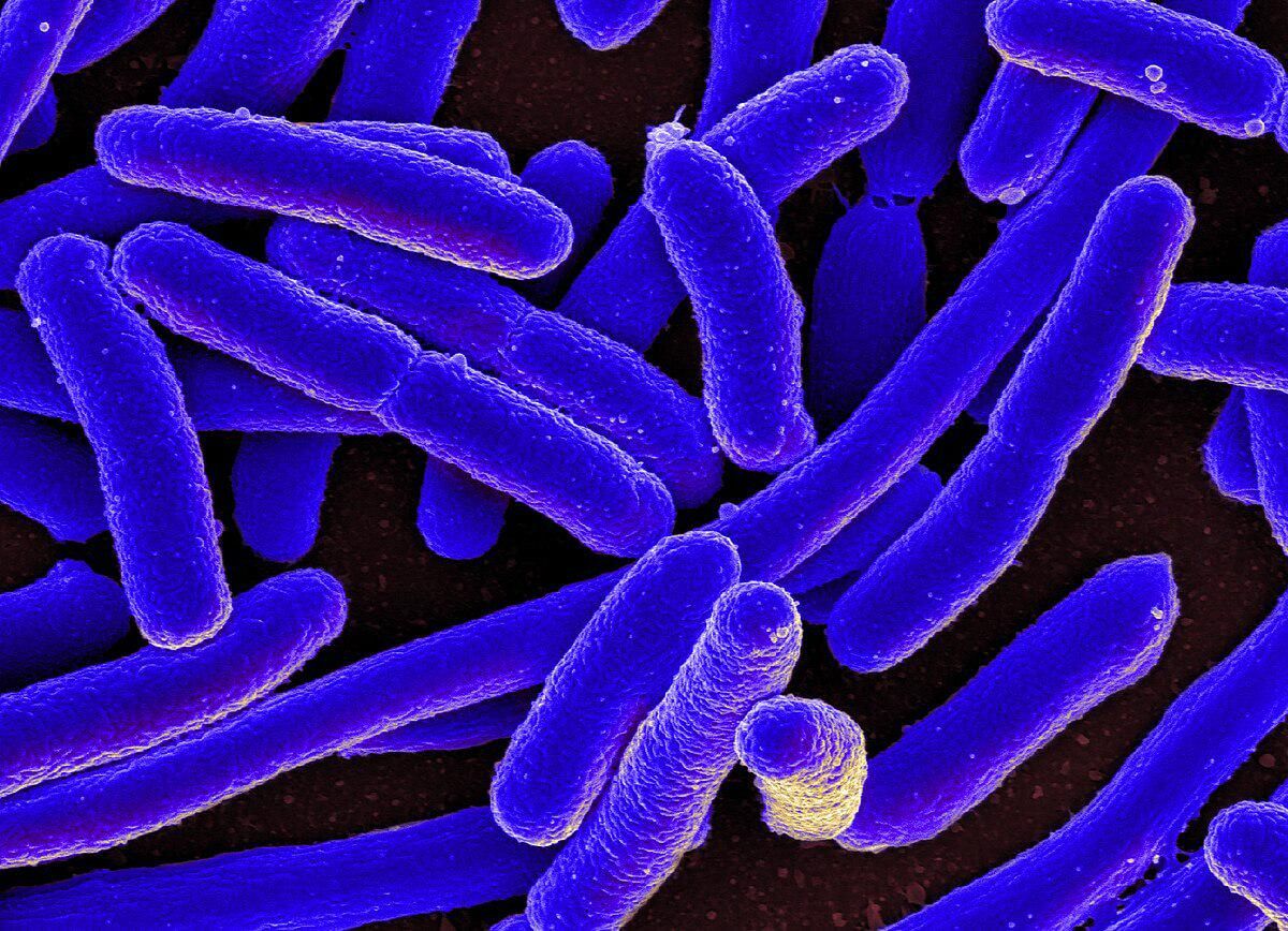 5 Fakta Escherichia coli, Bakteri yang Haram Ada di Makanan