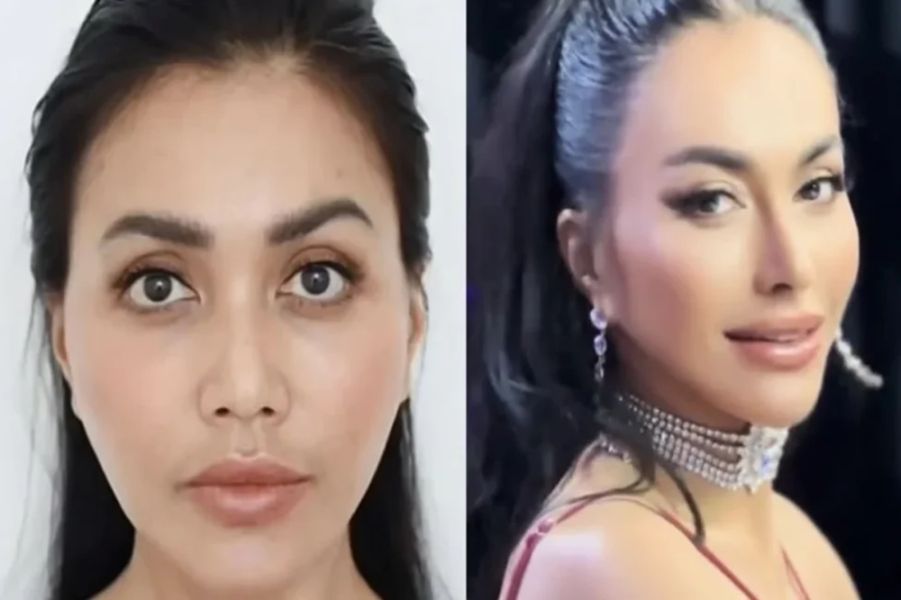 Denada Oplas Hidung di Thailand, Ini Alasannya!