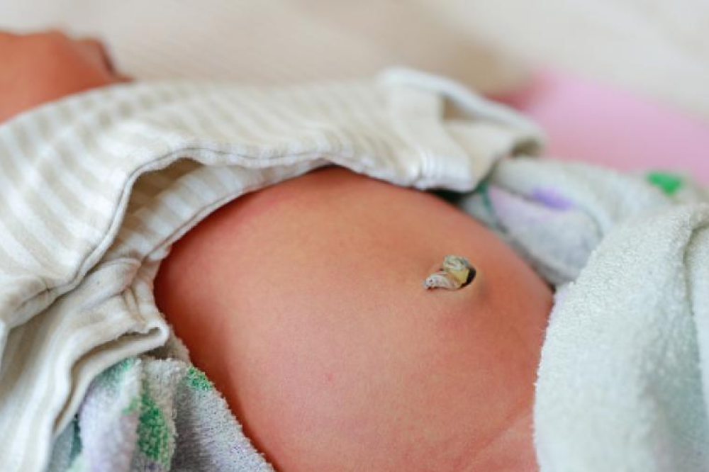 Kenapa Pusar Bayi Berdarah setelah Puput? Ini Penjelasannya