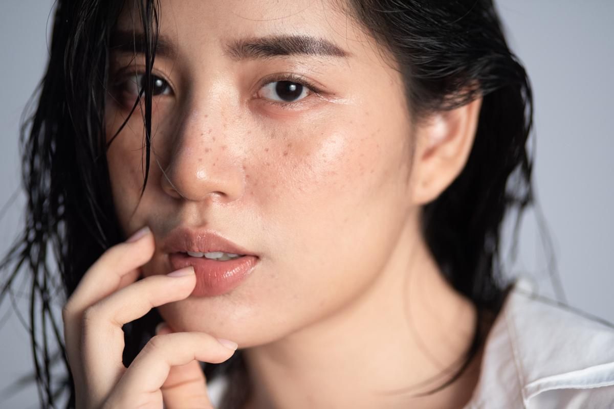 Penyebab Kulit Kusam dan Sensitif, Yuk Cari Tahu Solusinya Bela!