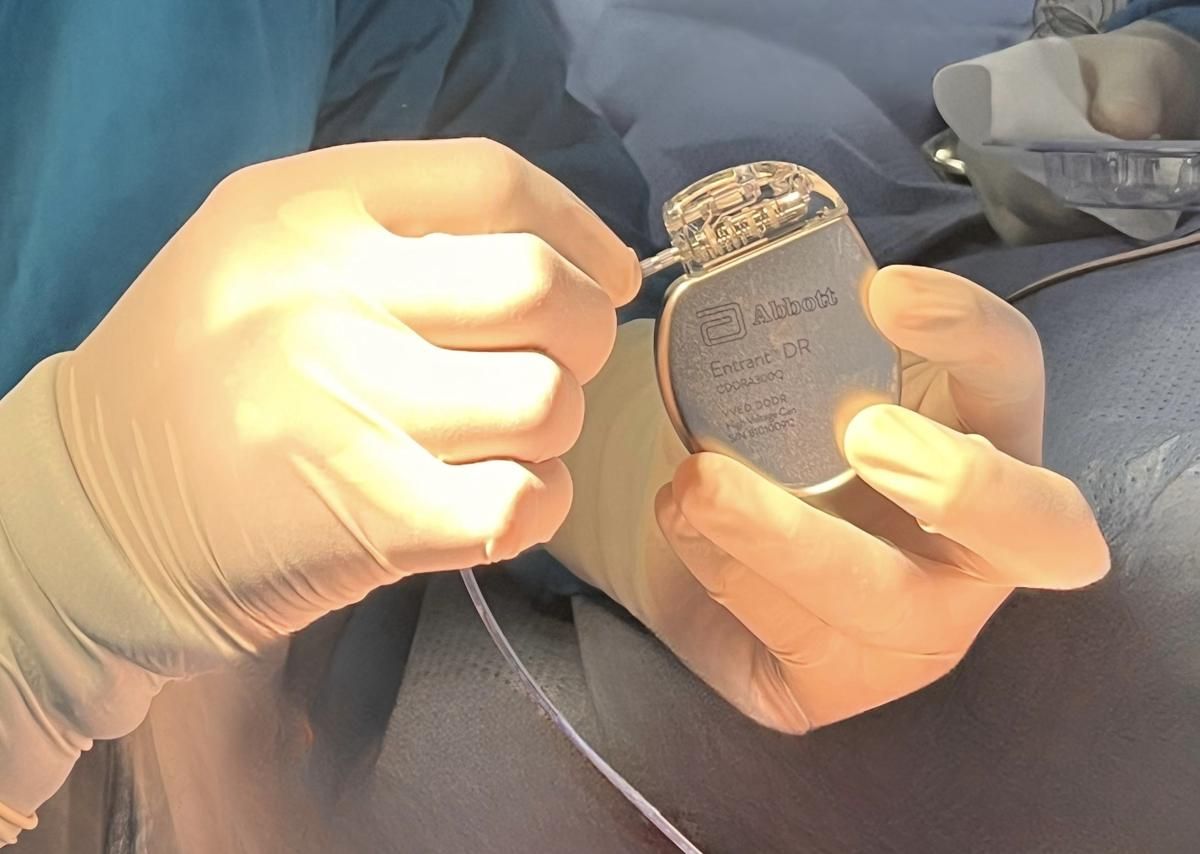 RS UNS Berhasil Implantasi ICD Bluetooth pada Jantung di Indonesia